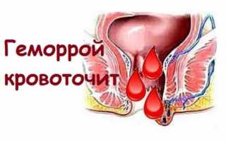 Геморроидальная кровоточивость и меры предупреждения