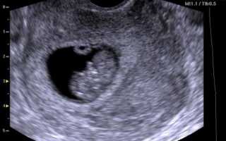 8 недель беременности размер плода фото УЗИ