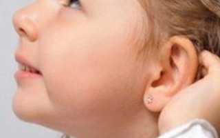 Почему у ребёнка разные уши?