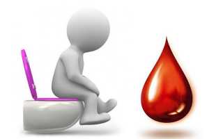 Самые эффективные свечи при геморроидальном  кровотечении